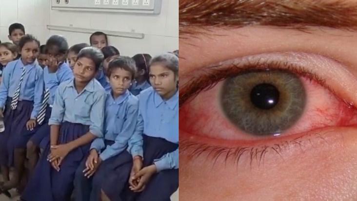 Simultaneously 24 children became victims of flu Simultaneously 24 children became victims of flu