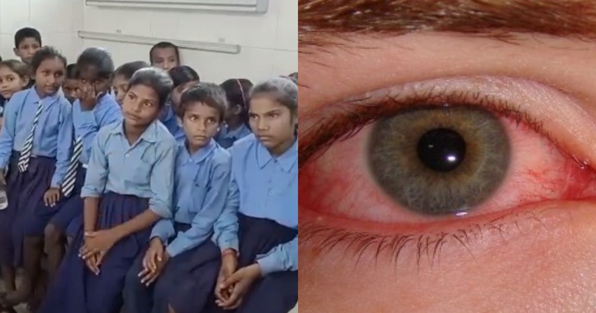  Simultaneously 24 children became victims of flu