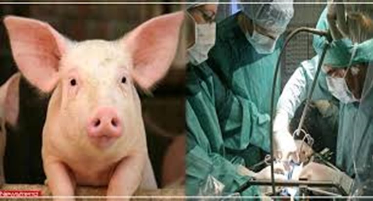 pig kidney in human body pig kidney in human body