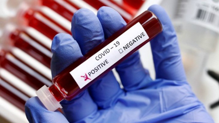 2 corona patients found in Patna, concern increased, health 