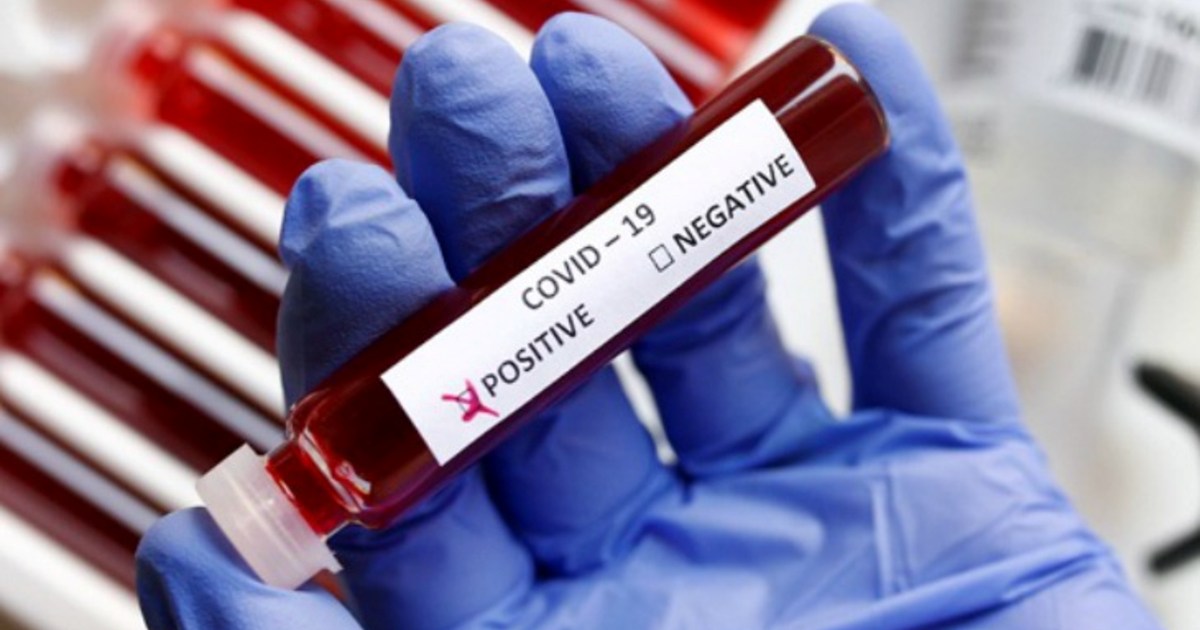 2 corona patients found in Patna, concern increased, health 