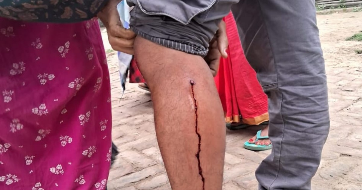 Shiv temple became an arena in Katihar, priest opened fire