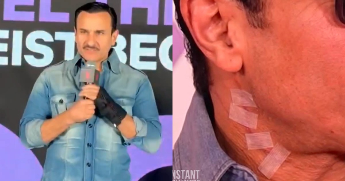 Injuries seen on Saif's neck, return to work after returning