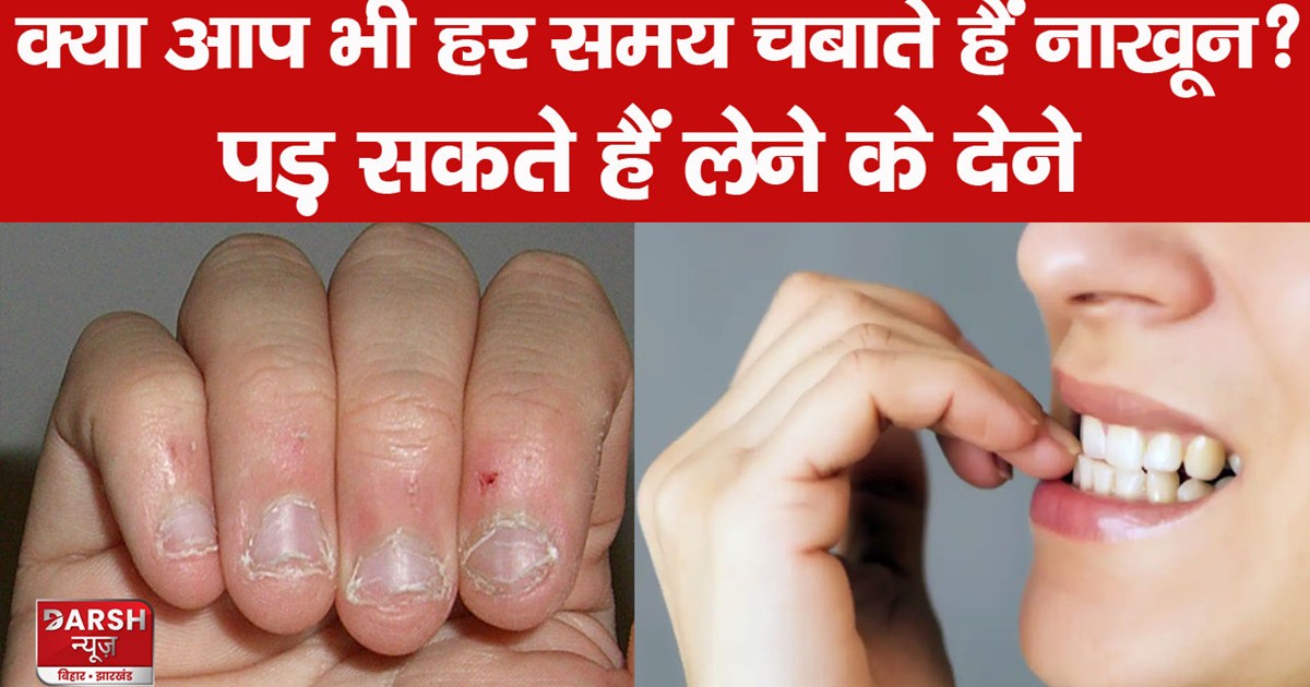 nail-biting-habit-can-ruin-your-oral-health-teeth