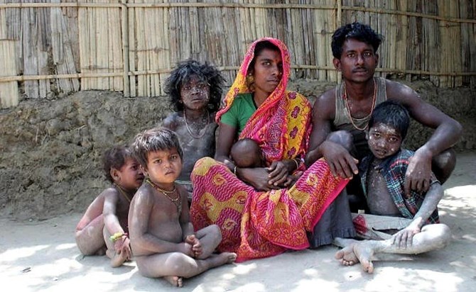 bihar poverty state after central government help bihar poverty state after central government help