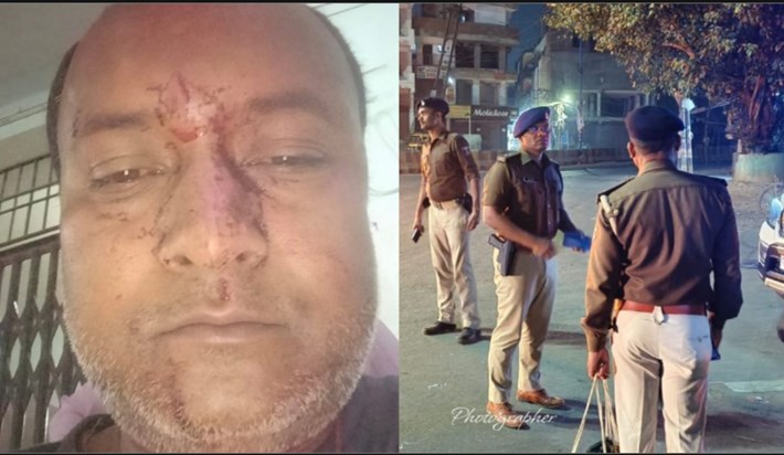 Journalist beaten up in Patna in the name of Holi riots Journalist beaten up in Patna in the name of Holi riots