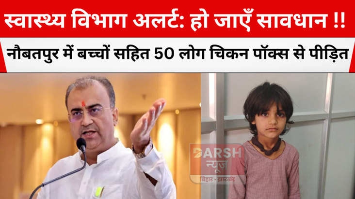 people suffer from chicken pox in Naubatpur