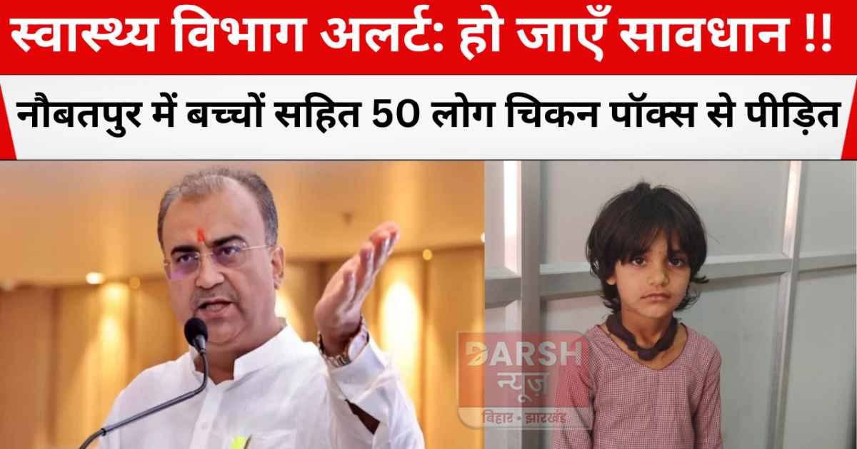 people suffer from chicken pox in Naubatpur