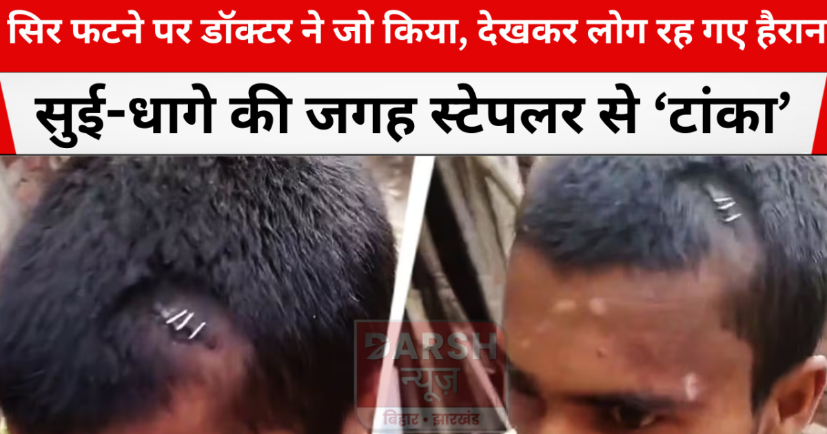 viral doctor's treatment in bihar 