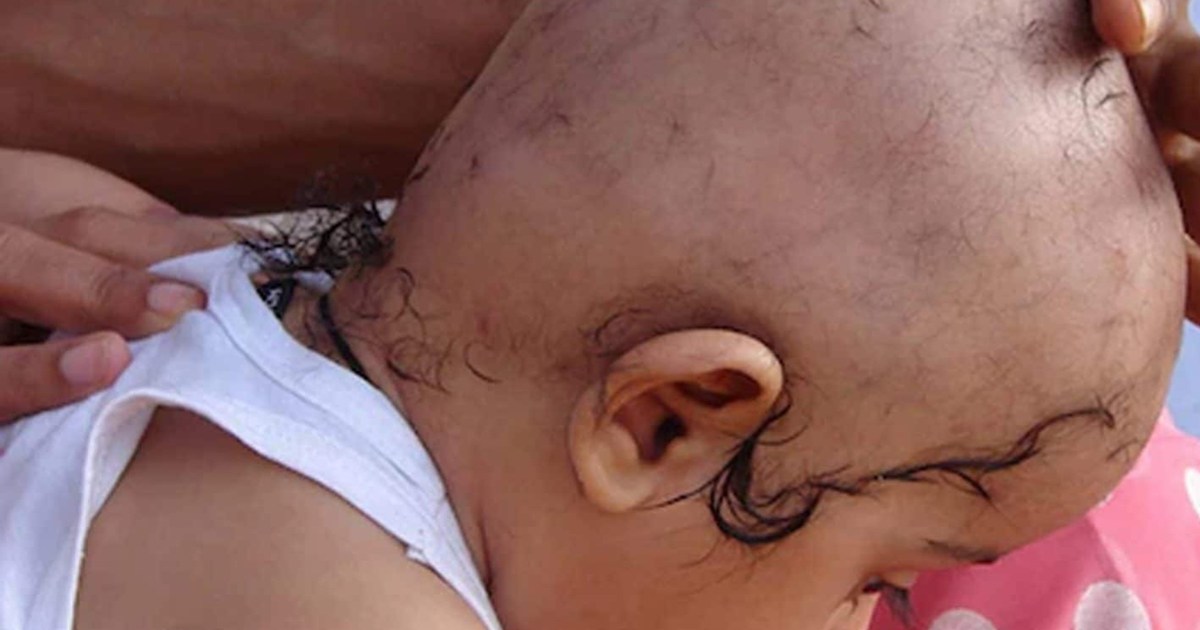 Death of brother and sister before mundan ceremony