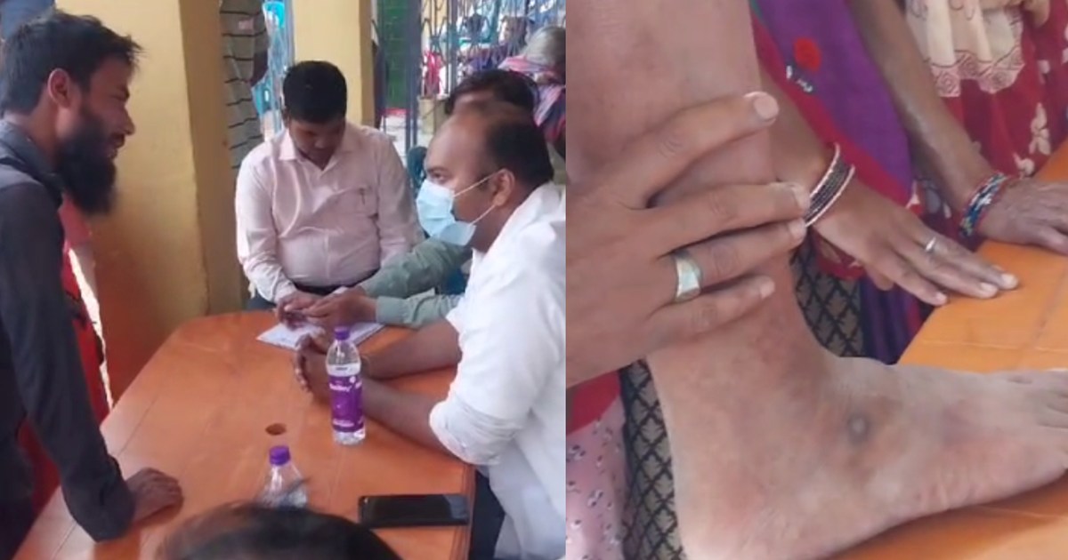 An atmosphere of fear due to unknown disease prevails in Gay