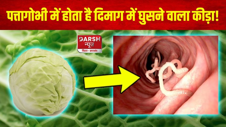 cabbage-dangerous-tapeworm-in-brain-patta-gobhi-khane-se-dim