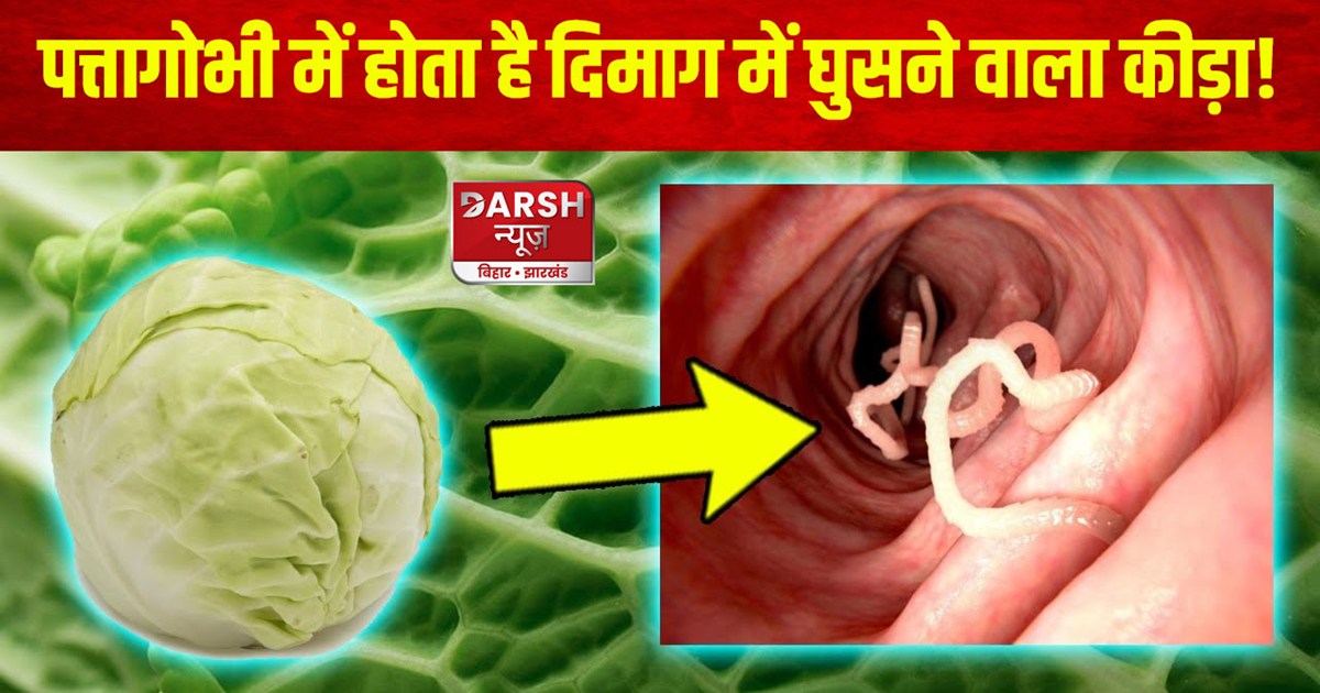 cabbage-dangerous-tapeworm-in-brain-patta-gobhi-khane-se-dim